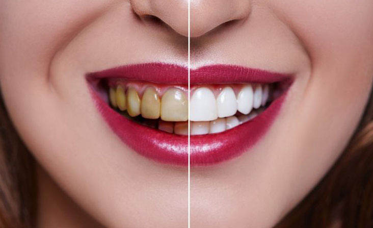 Cosmetic Dentistry at the AMC dental clinic in abudhabi